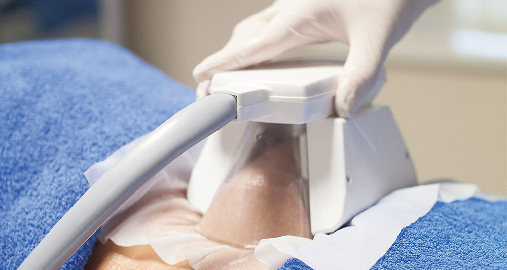 How Fat Freezing and HIFU Work Together? 2 Multiple Areas in One Session HIFU and Fat Freezing Hove