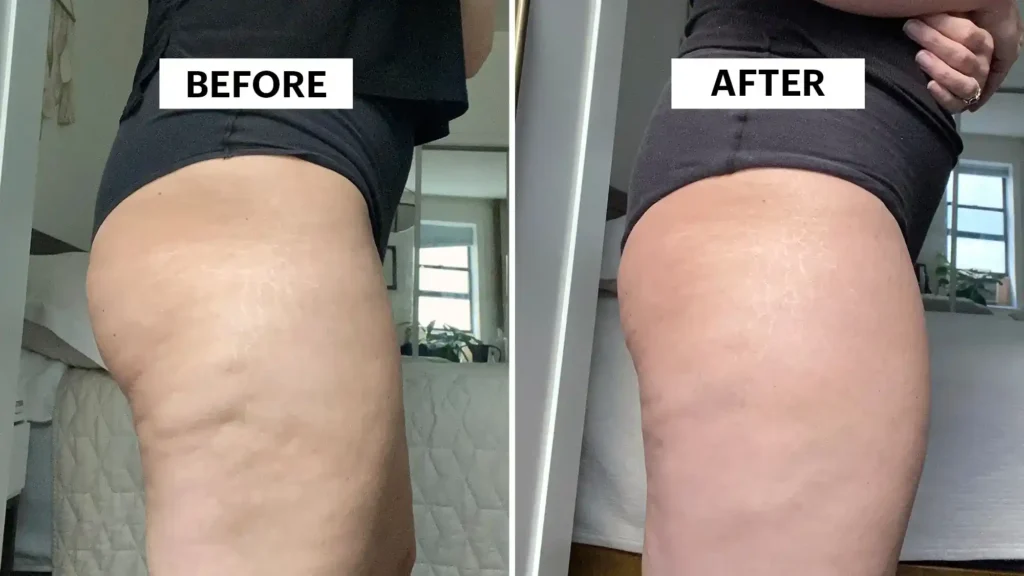 Do Toning Exercise Hove Really Tackle Cellulite?