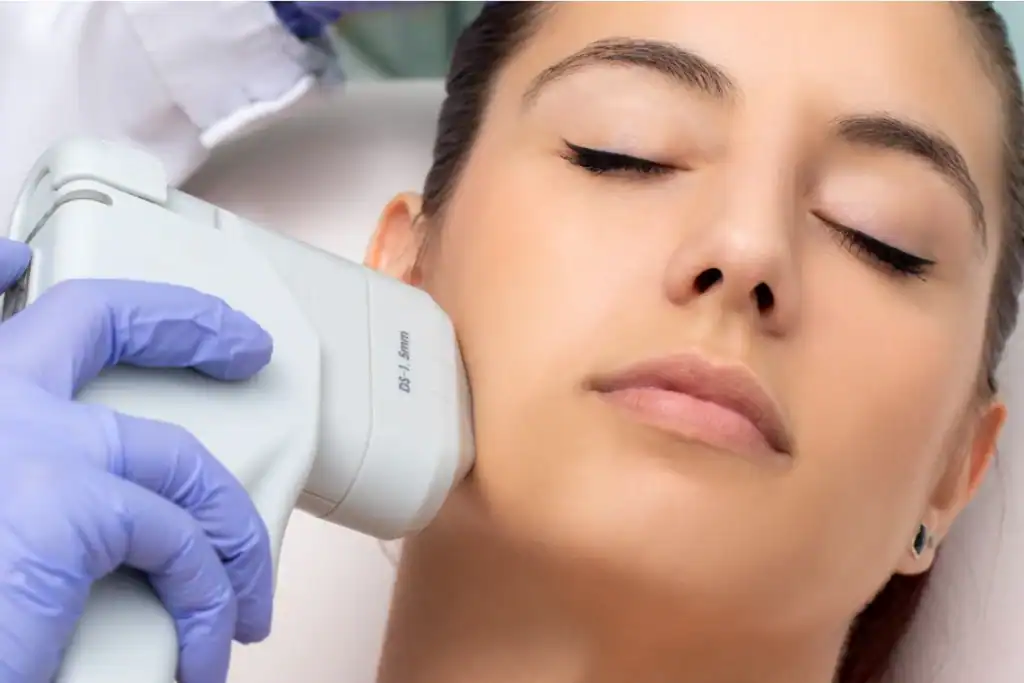 Discover the Perfect Duo: RF Microneedling and HIFU 2 Image of Morpheus8 And HIFU Combined with Lipo 360 Hove
